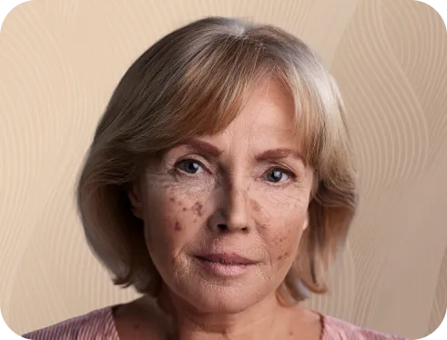 Professional Skincare