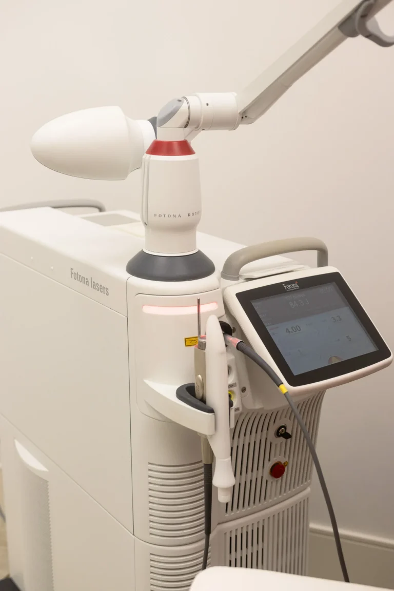 Fotona Laser Scar Resurfacing