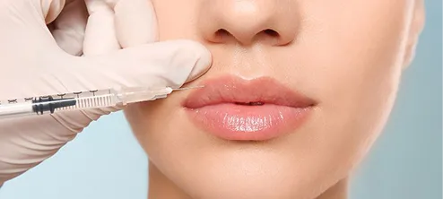 Lip Fillers