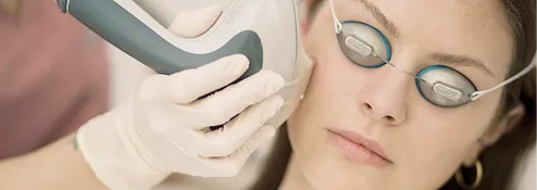 Limelight IPL