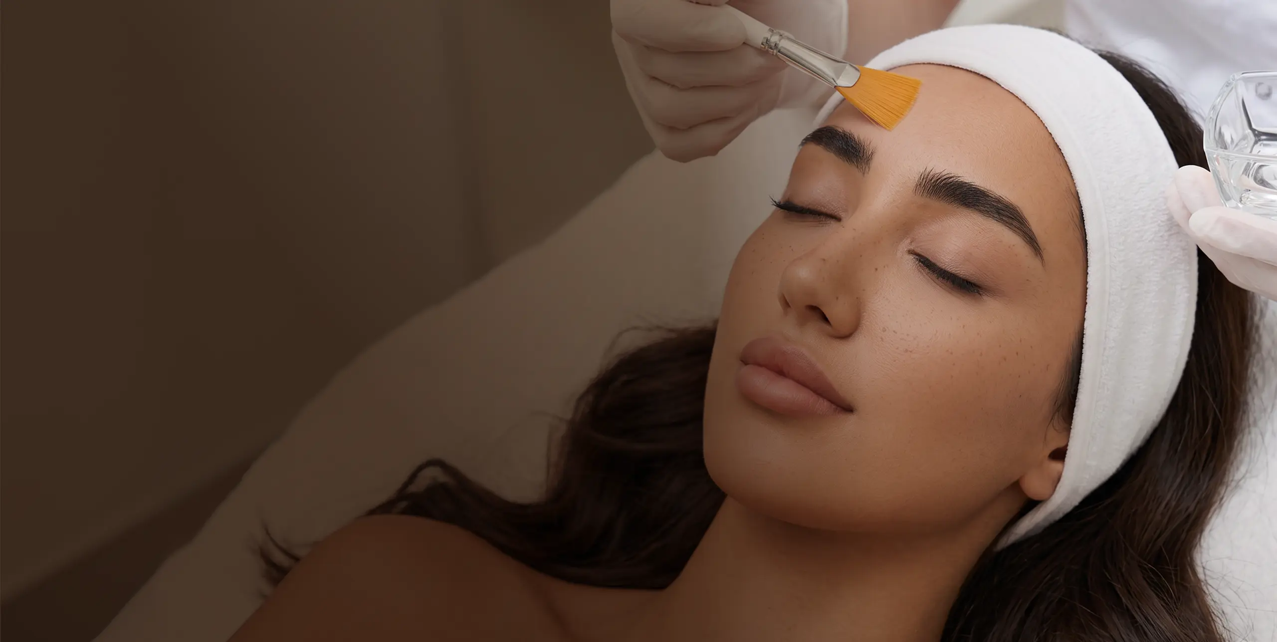 Chemical Peels