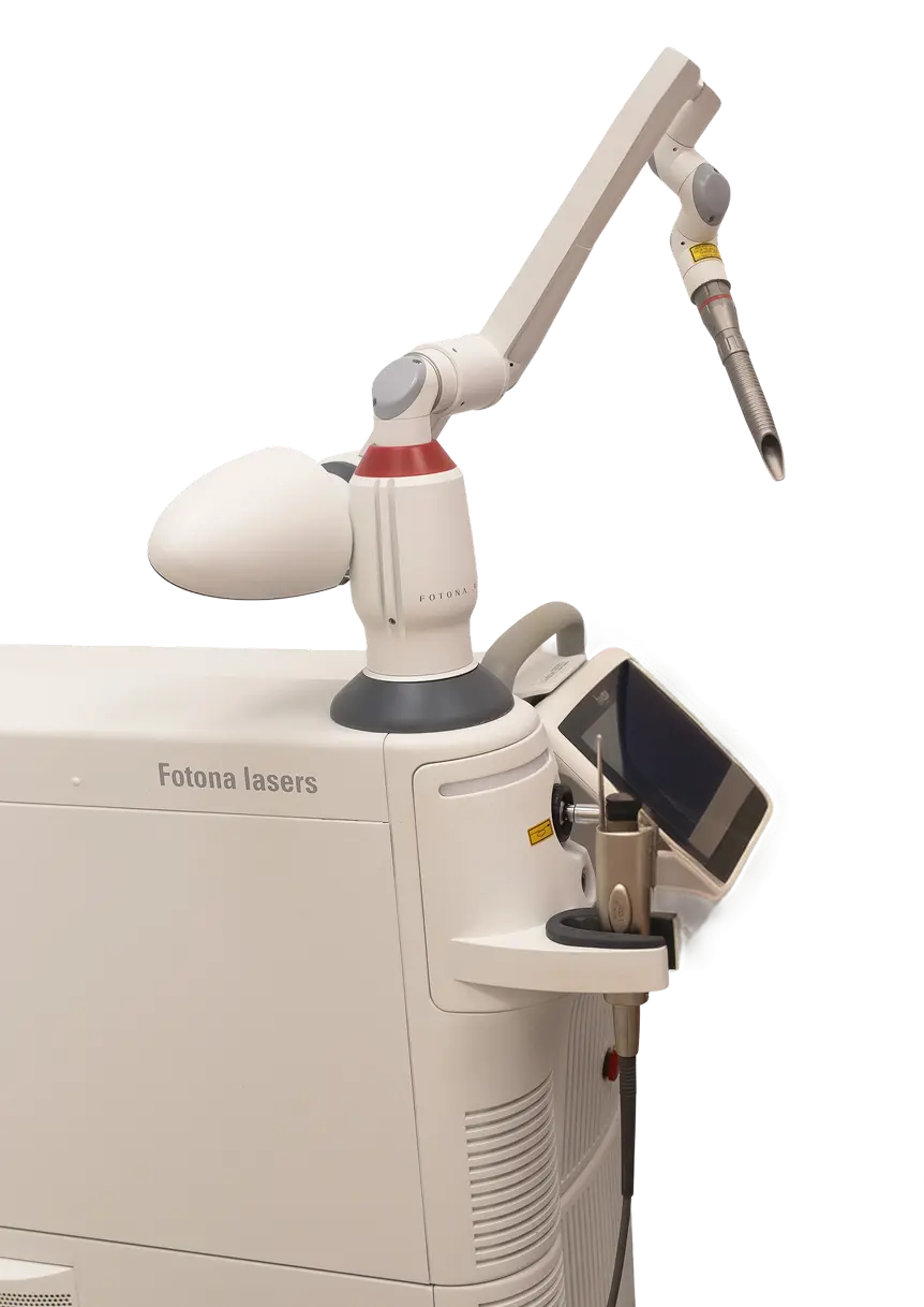 RF laser treatment