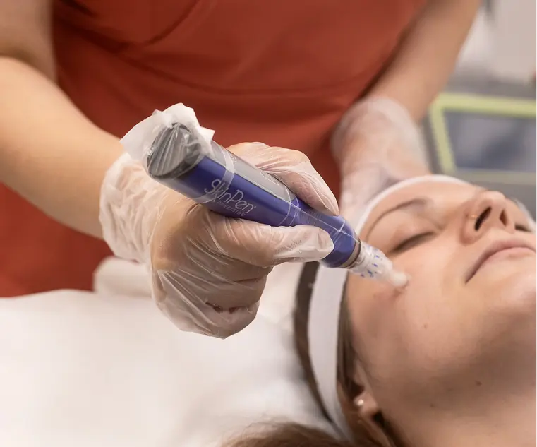 Skinpen Facial Closeup