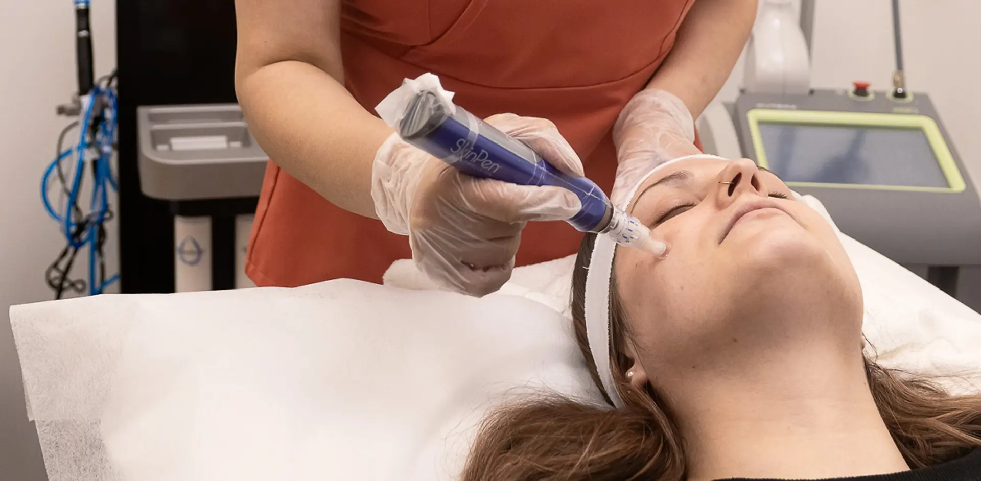 Skinpen Microneedling Treatment