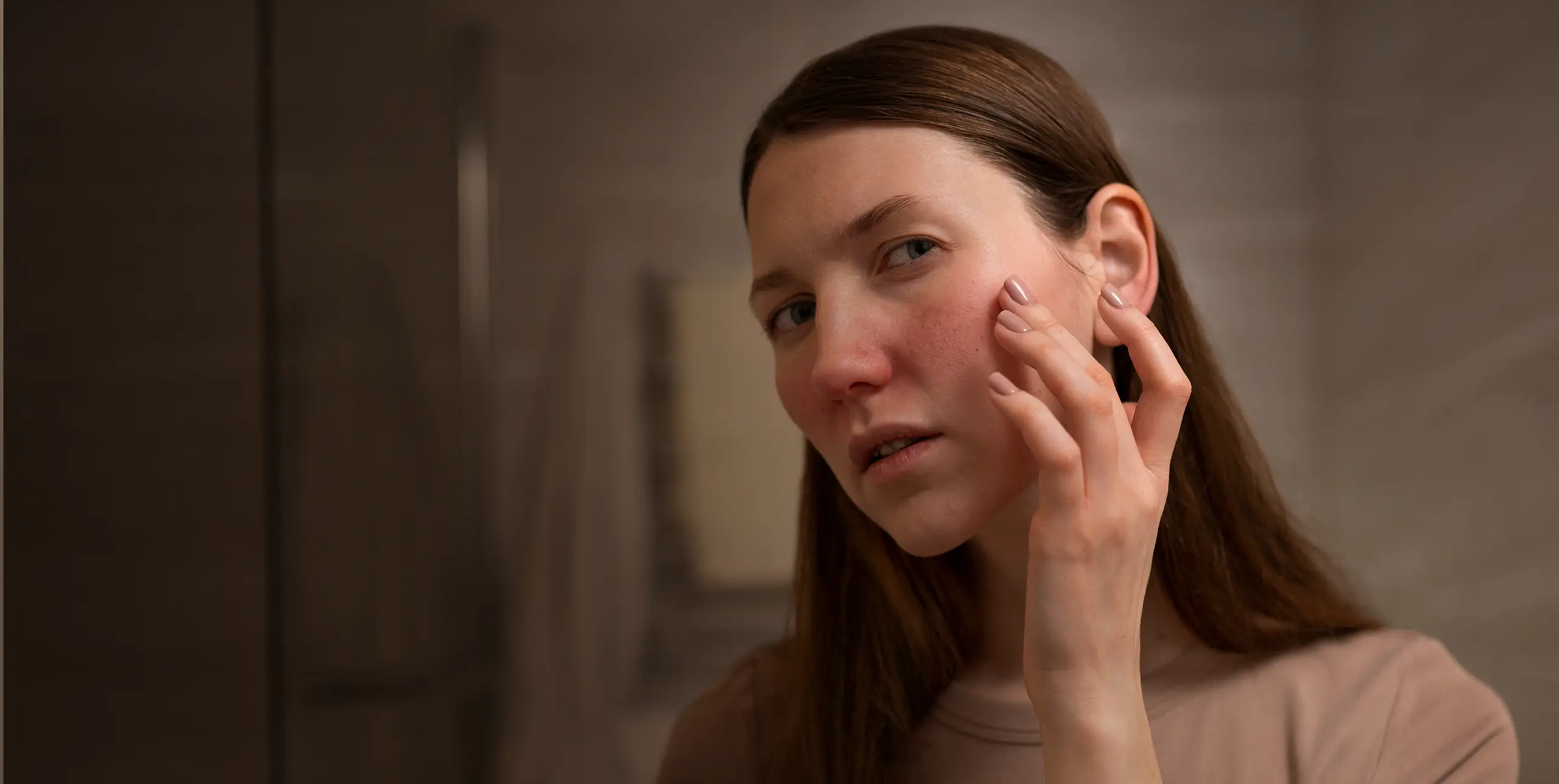 Woman Dealing with Rosacea Skin Condition Face
