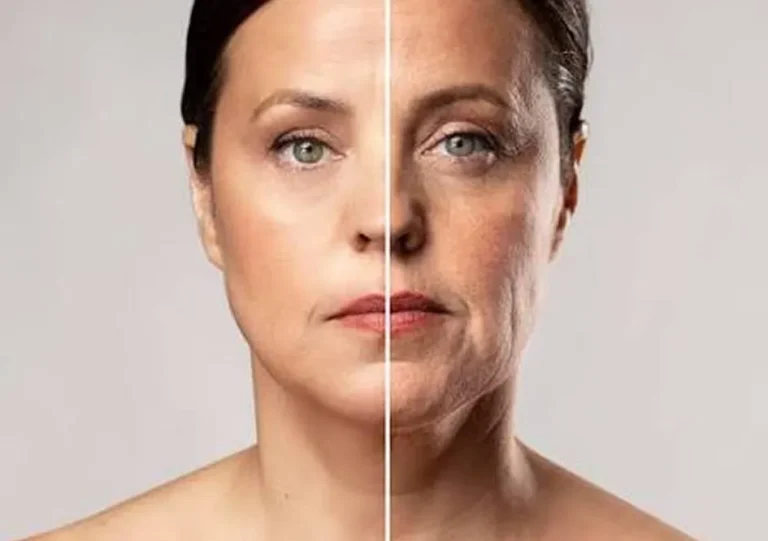 Skin Tightening