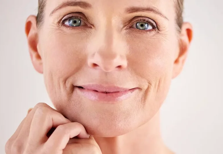 Non-Surgical Face Lift