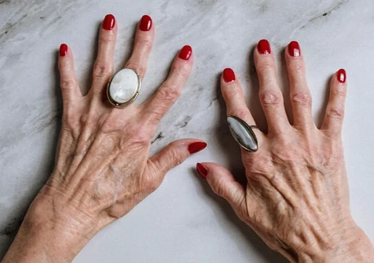 Ageing Hands